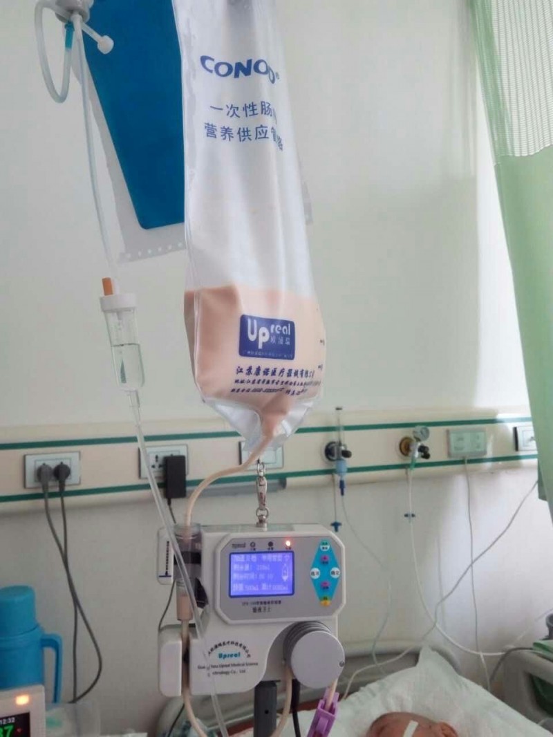 可加溫的腸內(nèi)營養(yǎng)泵 泵管 胃管