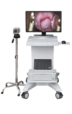 專(zhuān)業(yè)生產(chǎn)銷(xiāo)售陰道鏡