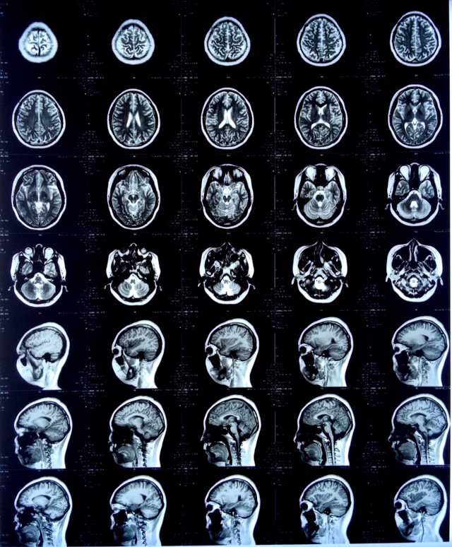 醫(yī)用膠片 熱敏膠片 廠家直銷
