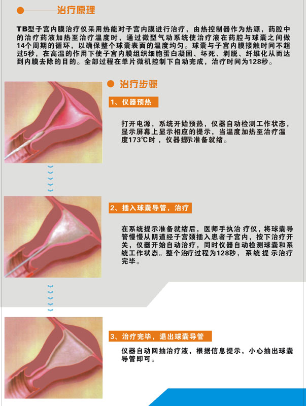 TB型子宮內(nèi)膜治療儀