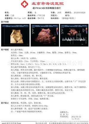 醫(yī)用打印膠片全國招商