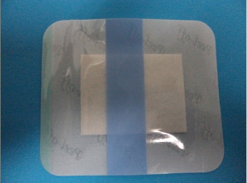 護(hù)臍貼（帶）