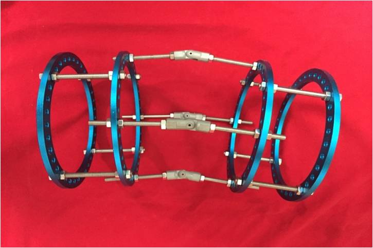 骨矯形(單平面)