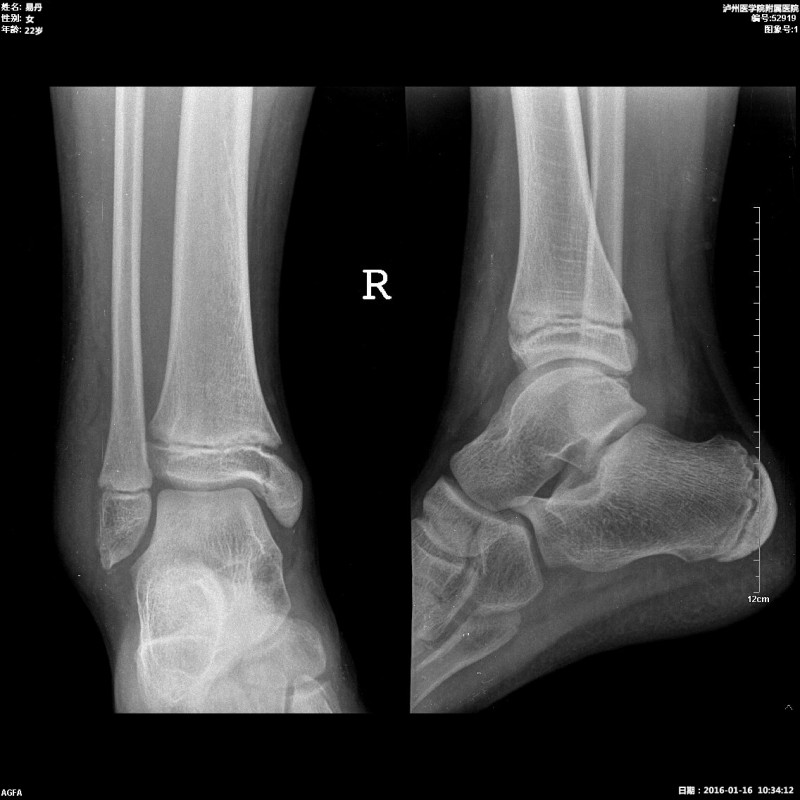 醫(yī)用膠片（B超、CT、DR）、自動(dòng)取片機(jī)