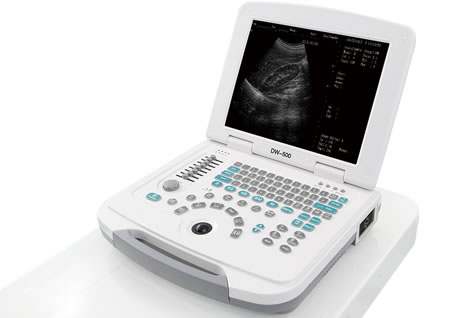 便攜式超聲診斷設(shè)備
