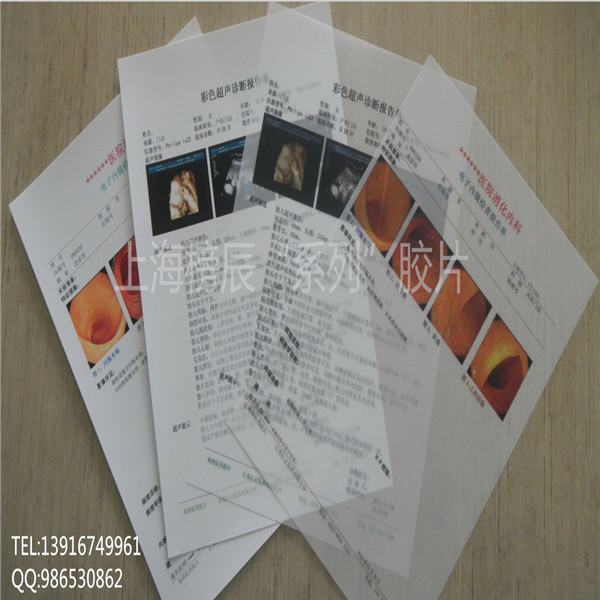 彩超a4瓷白噴墨膠片 A4醫(yī)用彩色噴墨打印防水膠片光面瓷白