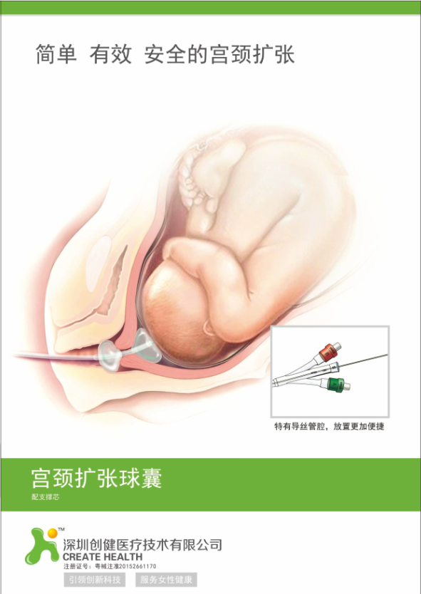一次性使用子宮頸擴張球囊導管