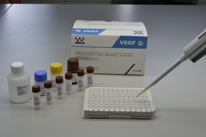 VEGF血管內皮生長因子（化學發(fā)光法）