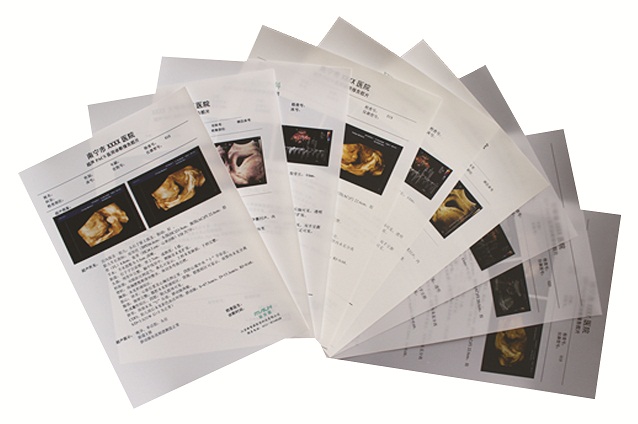 醫(yī)用打印膠片（商品名：超聲PACKS醫(yī)用診斷報告膠片）