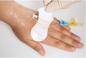 慧吉康醫(yī)用導(dǎo)管固定敷料A型