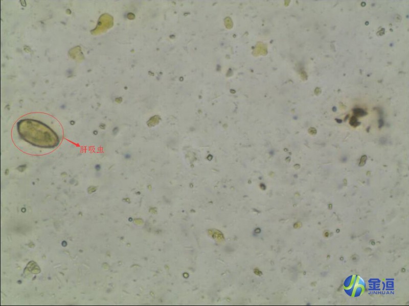 JHAFA-I 升級版 自動(dòng)糞便分析儀