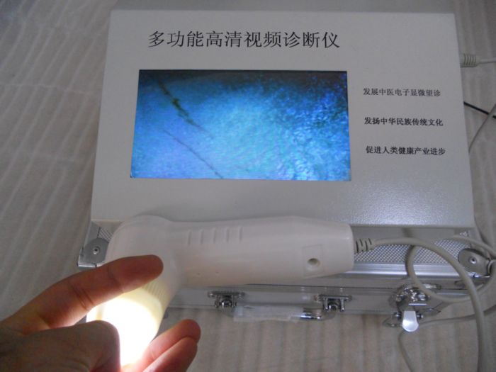 氣血檢測(cè)儀一體機(jī)