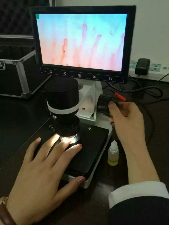 彩色微循環(huán)檢測儀