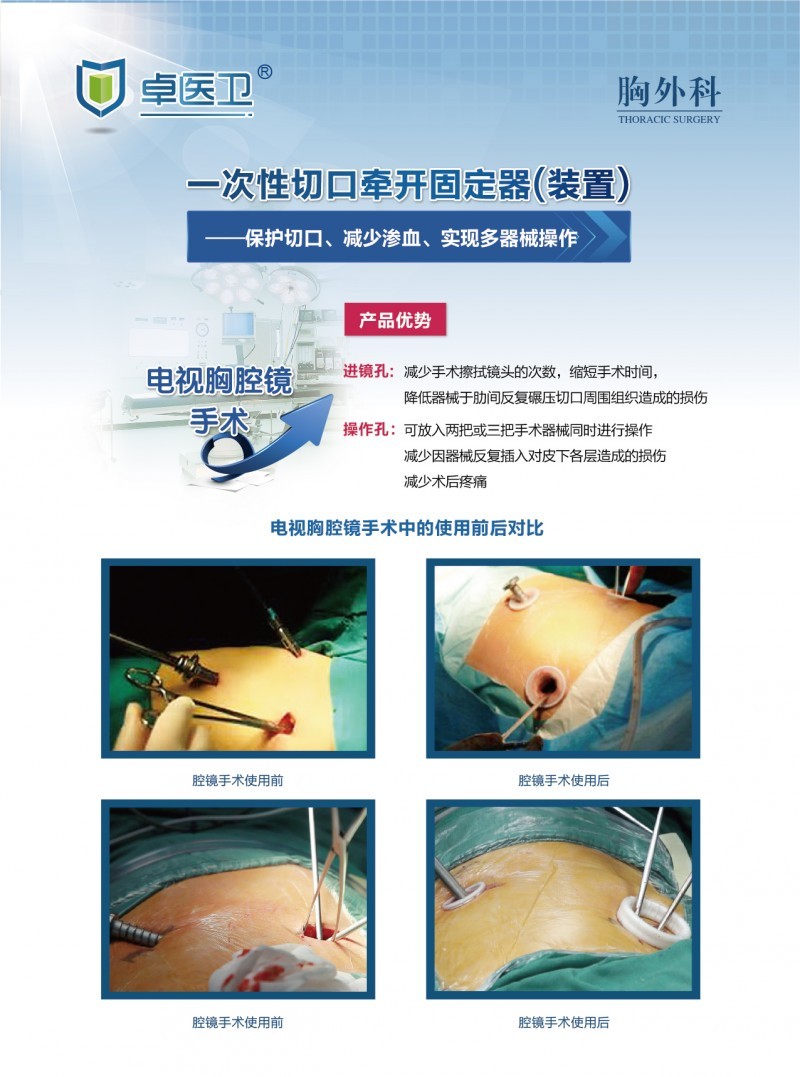 一次性切口牽開固定器（裝置）