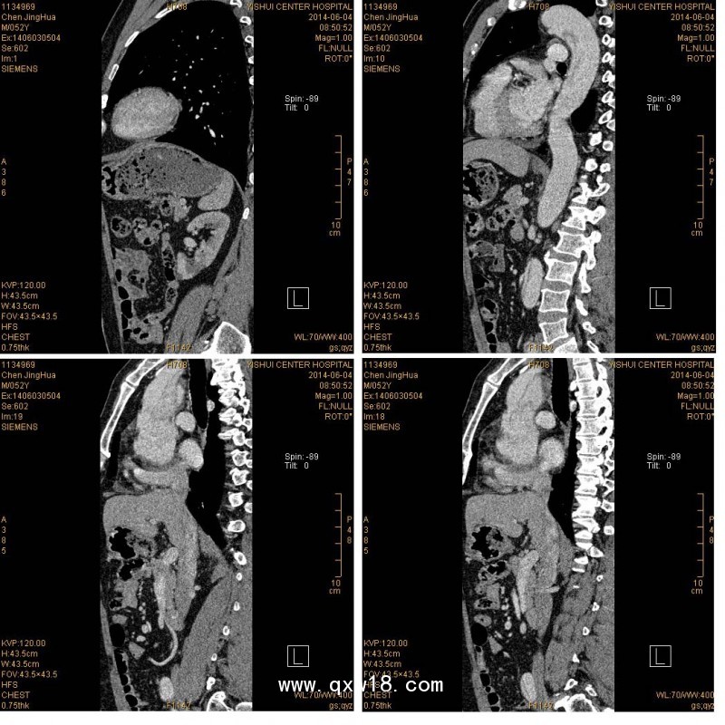 醫(yī)用膠片：藍基、瓷白、彩色影像膠片，影樓影像膠片