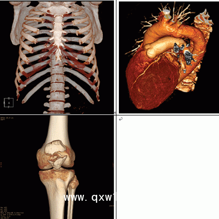 醫(yī)用膠片：藍基、瓷白、彩色影像膠片，影樓影像膠片