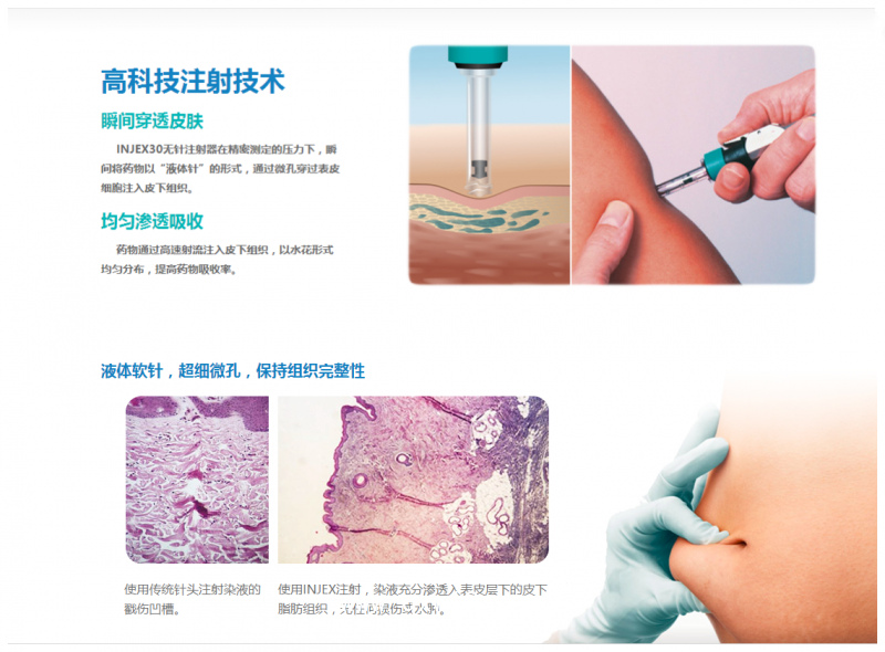 德國(guó)原裝無針注射器——益捷INJEX30【胰島素、生長(zhǎng)激素】