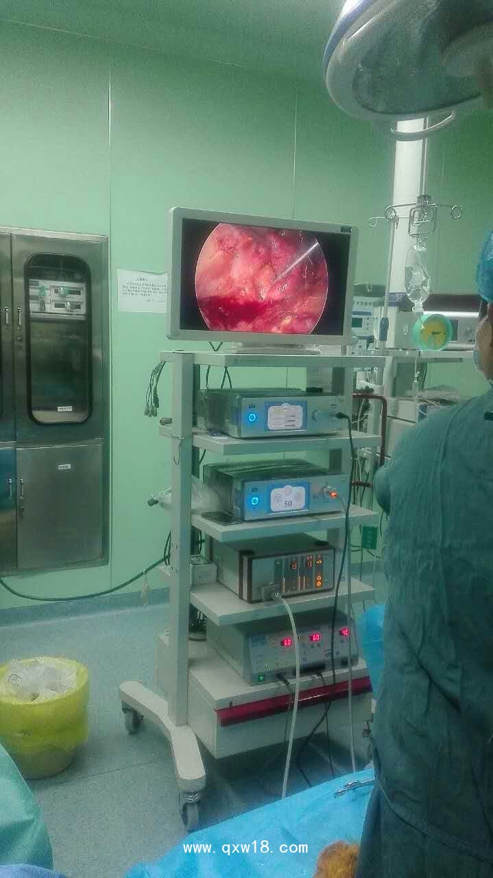 德國(guó)MGB高清腹腔鏡，高清膀胱鏡，高清輸尿管腎鏡，鼻竇鏡