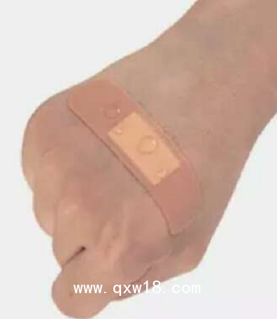 醫(yī)用創(chuàng)口貼