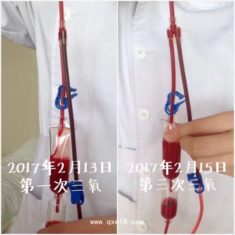 意大利歐恩蘭進(jìn)口醫(yī)用臭氧治療儀