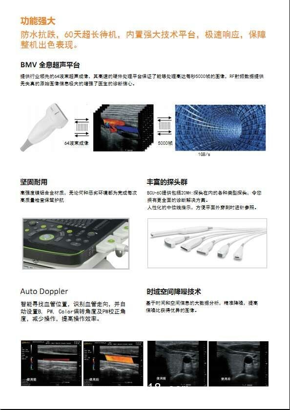 B超，監(jiān)護(hù)儀，心電圖，血壓計(jì)