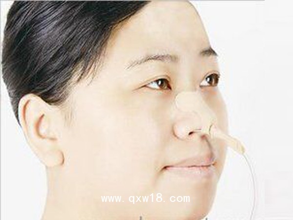 醫(yī)用導(dǎo)管夾 導(dǎo)管固定貼(吸氧管固定） G型小