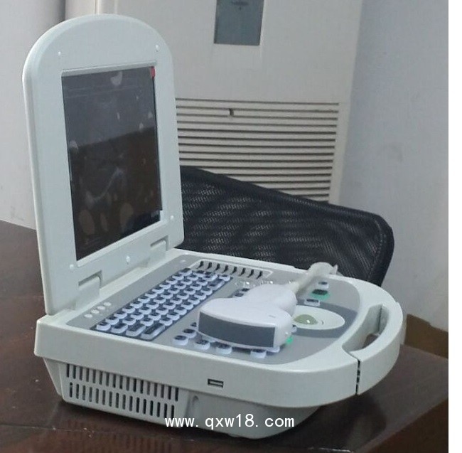 便攜式黑白B超 全數字超聲診斷系統(tǒng)手提式B超3W-2000