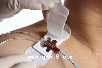 醫(yī)用導管夾 導管固定帖 B型小