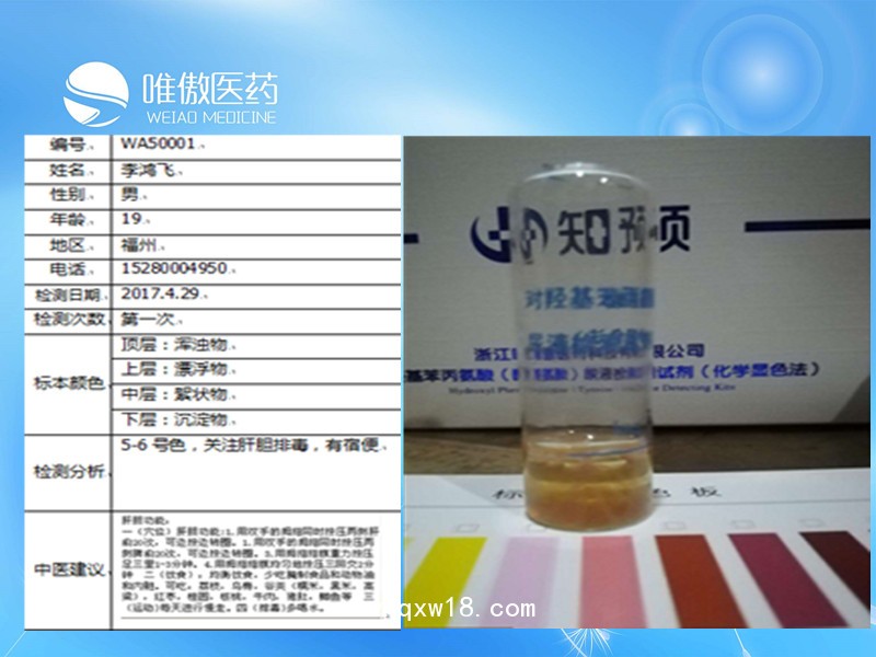 熱休克蛋白90α定量檢測(cè)試劑盒