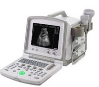 手提式黑白B超  全數(shù)字超聲診斷儀