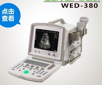 手提式黑白B超  全數(shù)字超聲診斷儀