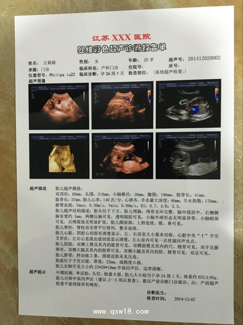 醫(yī)用超聲膠片 醫(yī)用膠片 醫(yī)用B超膠片 醫(yī)用彩超膠片