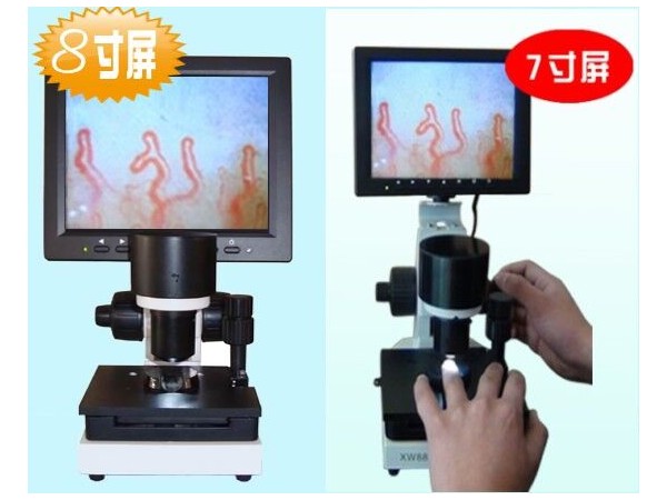 微循環(huán)檢測(cè)儀 微循環(huán)檢測(cè)儀招商