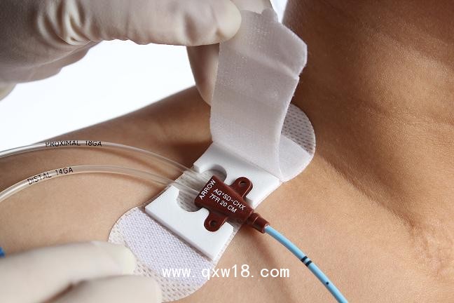 透氣膠貼（非織造布膠帶）B型（?。?>
            <div   id=