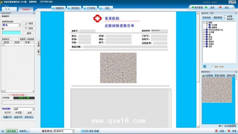 巨渺 皮膚真菌鏡檢 影像工作站 皮膚真菌圖文報告系統(tǒng)