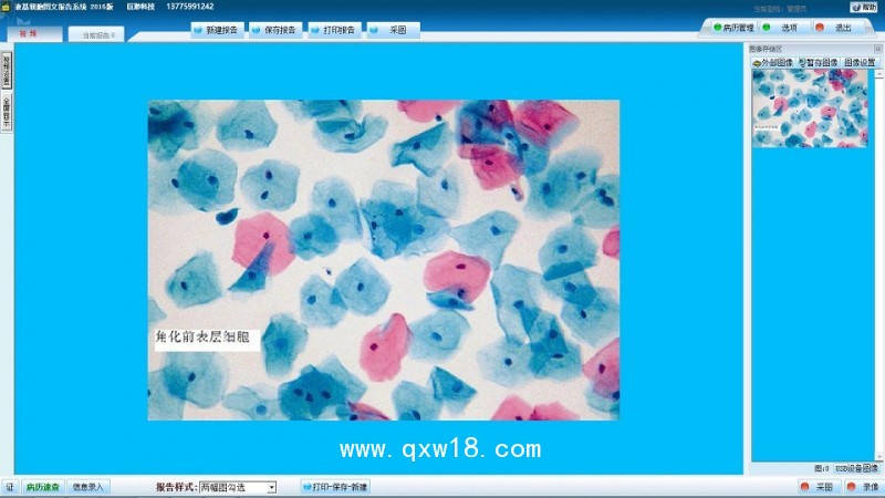 液基薄層細(xì)胞學(xué)檢測系統(tǒng) TBS TCT液基圖文報(bào)告系統(tǒng)軟件