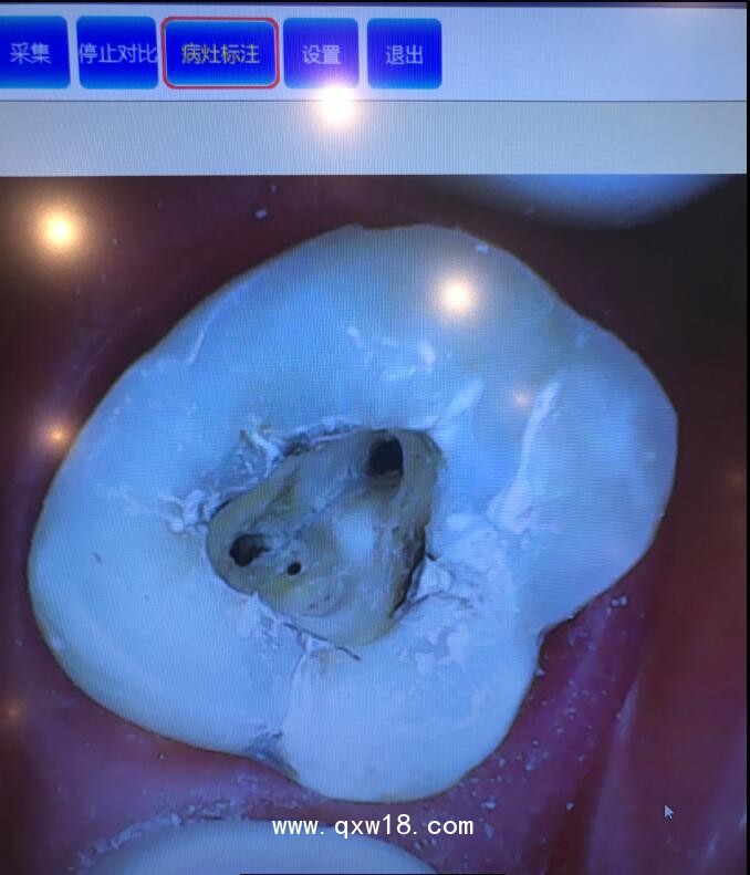 尤尼康一體機(jī)內(nèi)窺鏡