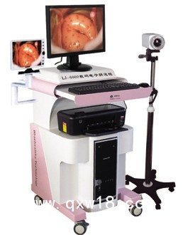 陰道鏡，高清陰道鏡，電子陰道鏡