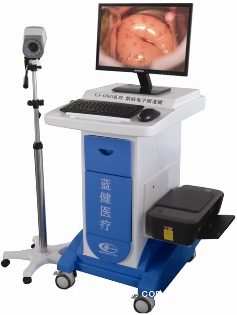 陰道鏡，高清陰道鏡，電子陰道鏡