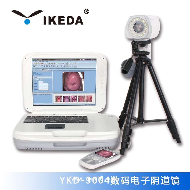 供應(yīng)紅外乳腺檢查儀|內(nèi)窺鏡攝像機(jī)|數(shù)碼電子陰道鏡