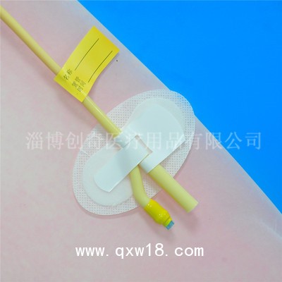 體表導(dǎo)管固定裝置