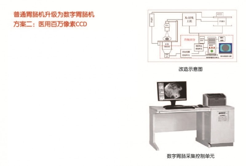 普通胃腸機(jī)升級(jí)為數(shù)字胃腸機(jī)