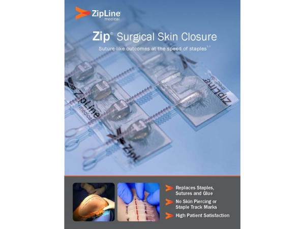 捷膚聯(lián)無創(chuàng)高強度皮膚縫合器