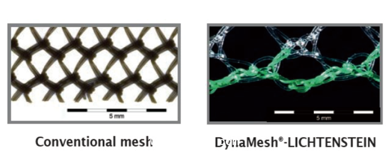 德國PVDF材質(zhì)疝氣補片-IPOM