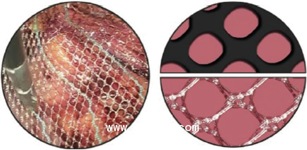 德國(guó)PVDF材質(zhì)疝氣補(bǔ)片-CICAT