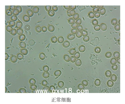 【惠斯安普】EIS紅細(xì)胞影像系統(tǒng)