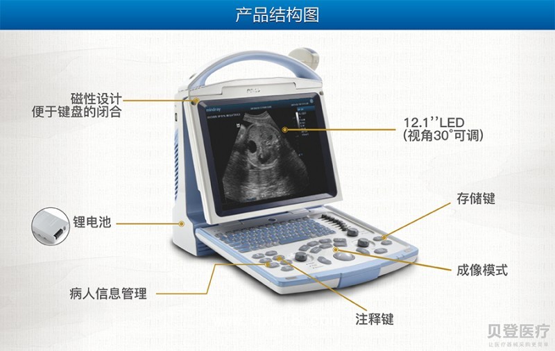 便攜式b超機 DP10型全數(shù)字超聲診斷系統(tǒng)