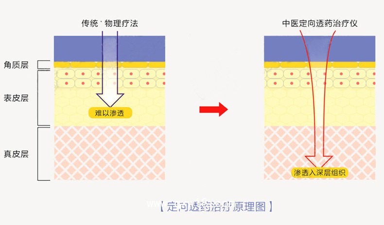 中藥離子導入治療儀性價比