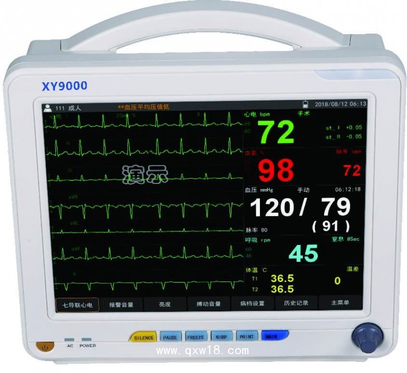 多參數(shù)監(jiān)護(hù)儀