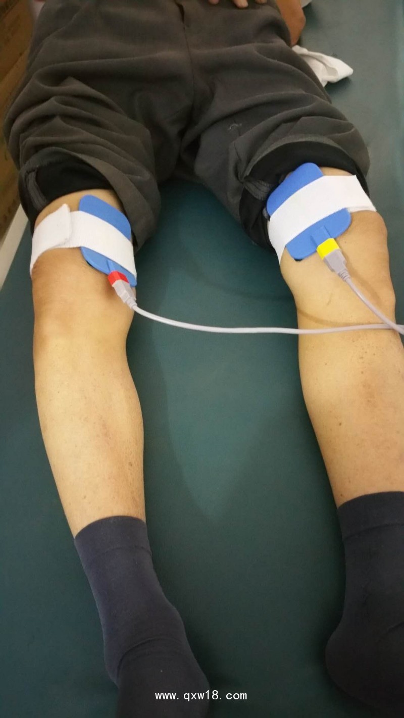 中藥離子導(dǎo)入治療儀